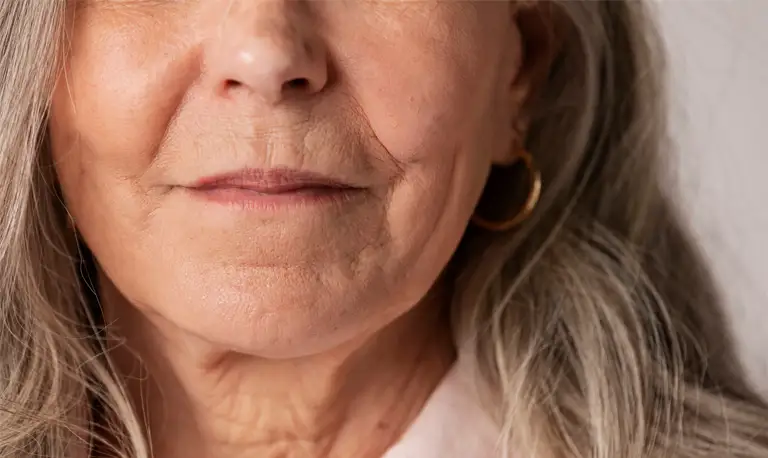 introduction of biotech method for skin rejuvenation - روش بایوتک در جوانسازی پوست شما