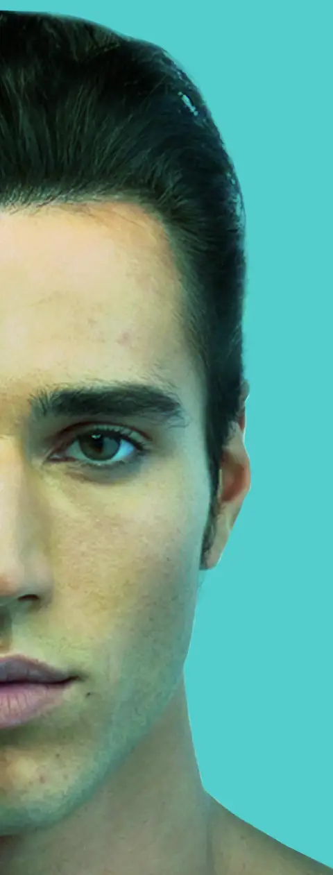 an early male pattern baldness in suit thinking for hair loss treatment, jotem clininc - درمان ریزش مو با تکنیک بایوتک و سلول های بنیادی در کلینیک ژتم