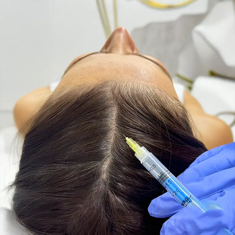 stem cell hair loss treatment in jotem beauty clinic - درمان تخصصی ریزش مو از طریق سلول های بنیادی و بایوتک 2
