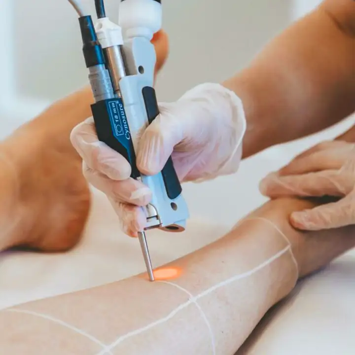 cynosure laser hair removal services - خدمات رفع موهای زائد با دستگاه ساینسور الکساندرایت آمریکا