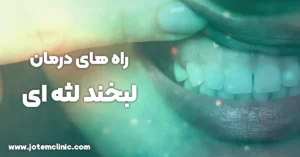 gummy smile treatment - راه های درمان لبخند لثه ای
