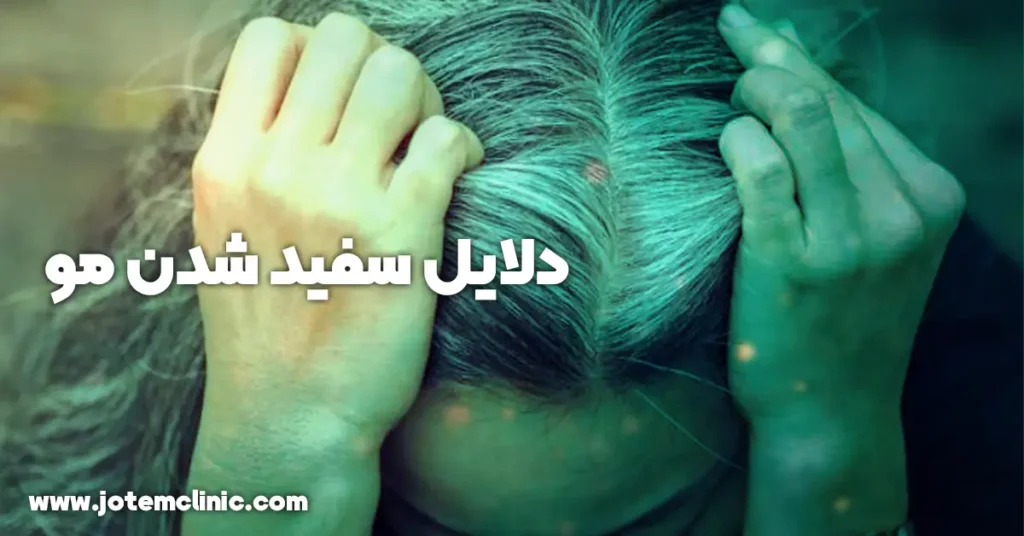 Causes of hair graying - دلایل سفید شدن مو