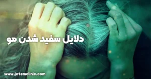 Causes of hair graying - دلایل سفید شدن مو