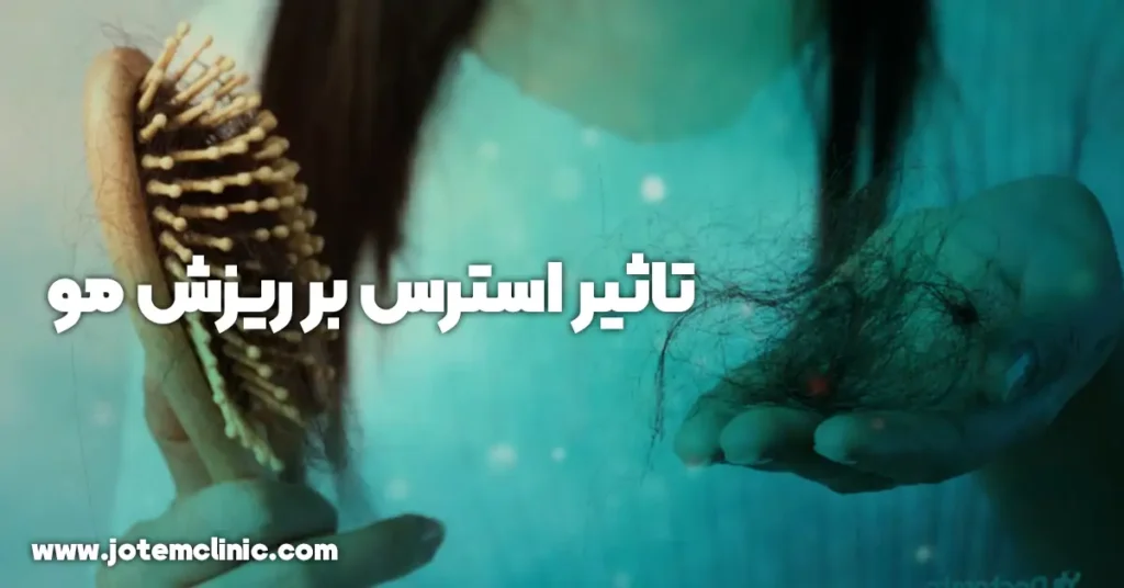 how stress affects hair loss - نقش استرس در ریزش مو ها