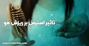 how stress affects hair loss - نقش استرس در ریزش مو ها