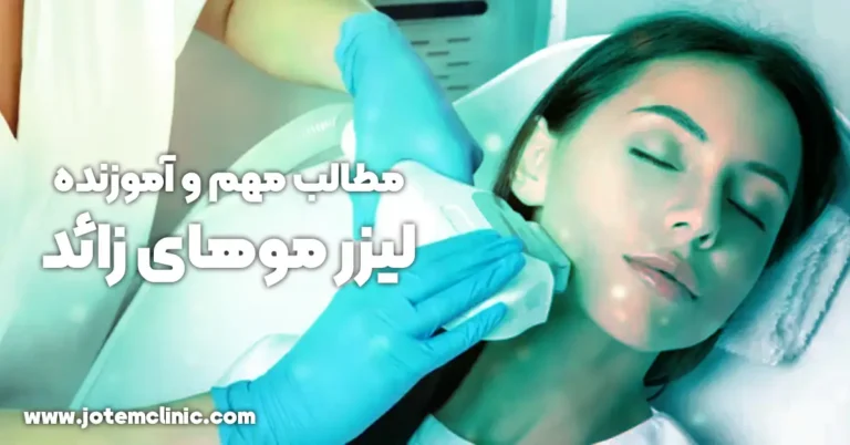 useful articles about laser unwanted hairs - مقالات مفید و آموزنده در زمینه لیزر موهای زائد صورت و بدن