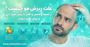 Understanding-Hair-Loss_-Causes-and-Treatments - علت اصلی ریزش مو