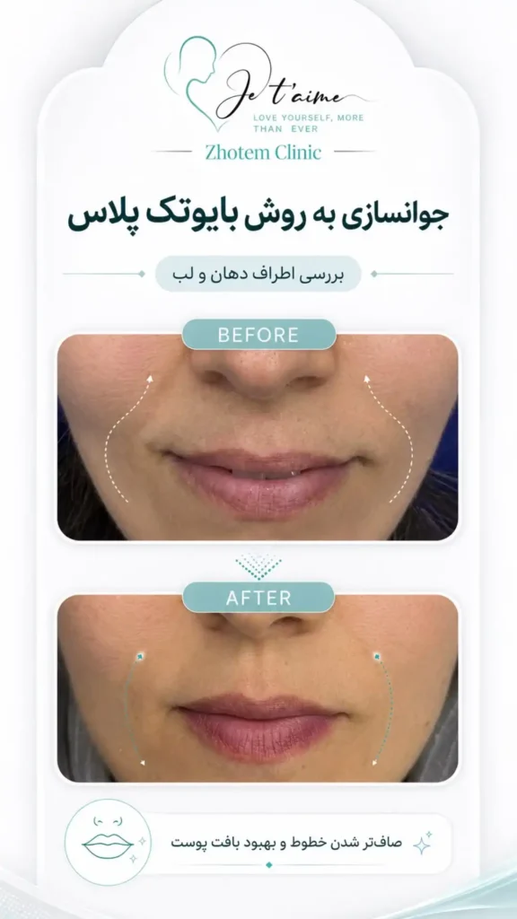 hand,neck and face skin rejuvenation in jotem clinic in isfahan - خدمات جوانسازی پوست دست، گردن و صورت در کلینیک ژتم در اصفهان - جوان سازی