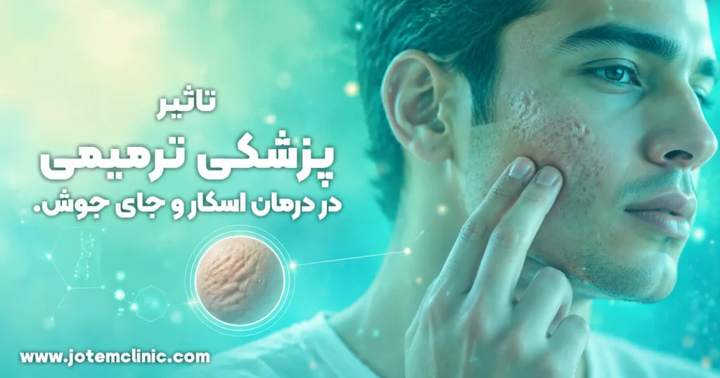 the-impact-of-regenerative-medicine-in-treating-scars-and-acne-marks - تاثیر پزشکی ترمیمی در درمان اسکار و جای جوش